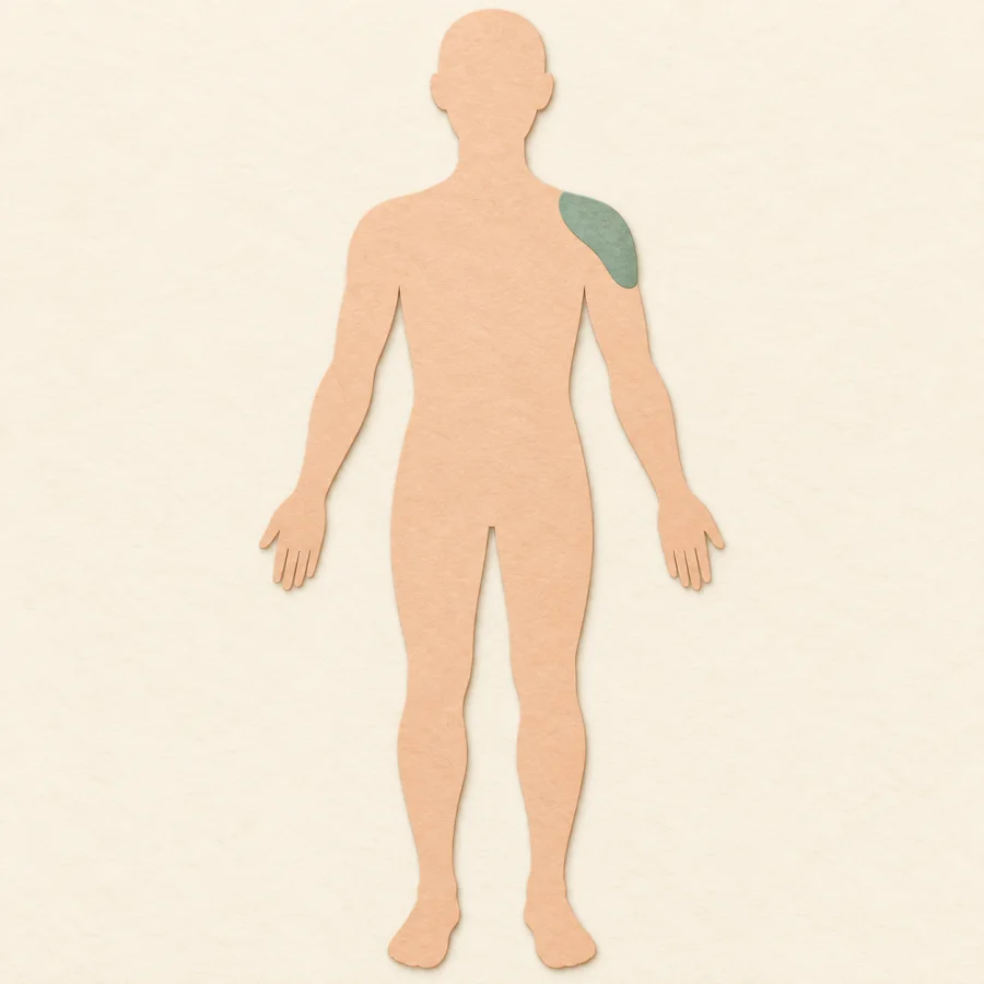 A marked spot on a body